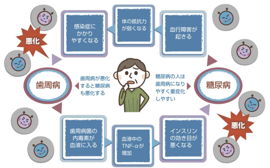 歯周病と糖尿病の関係性のイラスト