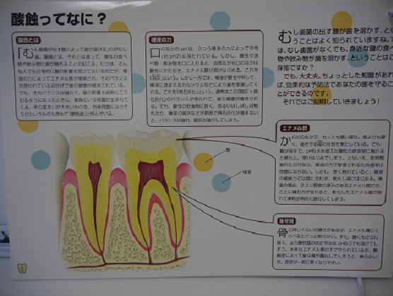 酸蝕の解説